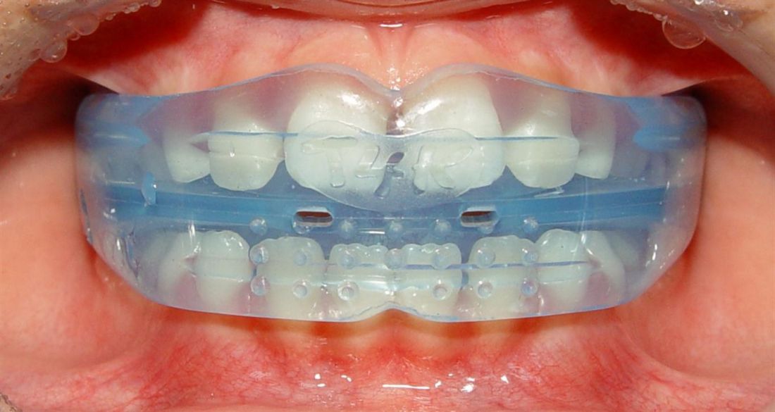 Пластина ортодонтическая фото